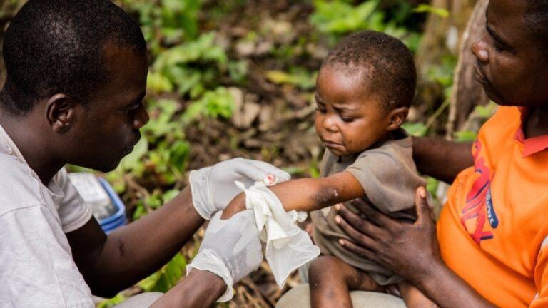 RDC : 3 cas de Monkeypox détectés à Kinshasa